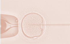 Intra Cytoplasmic Sperm Injection (ICSI) Treatment in Chennai