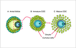 In Vitro Maturation-IVM